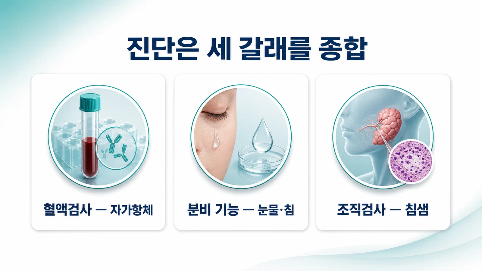 쇼그렌증후군 진단은 혈액·분비 기능·조직 세 갈래를 종합
