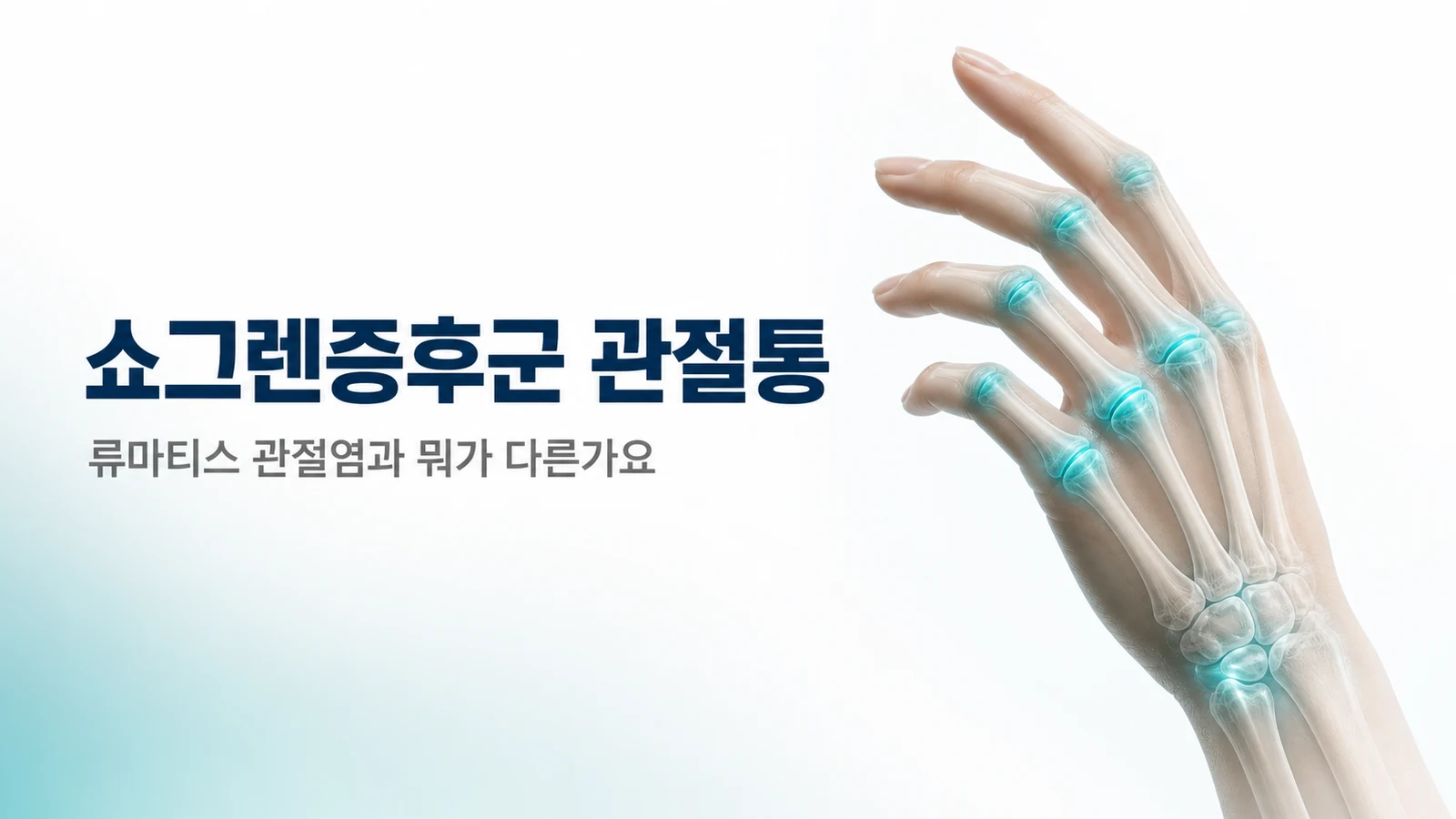쇼그렌증후군 관절통, 류마티스 관절염과 뭐가 다른가요