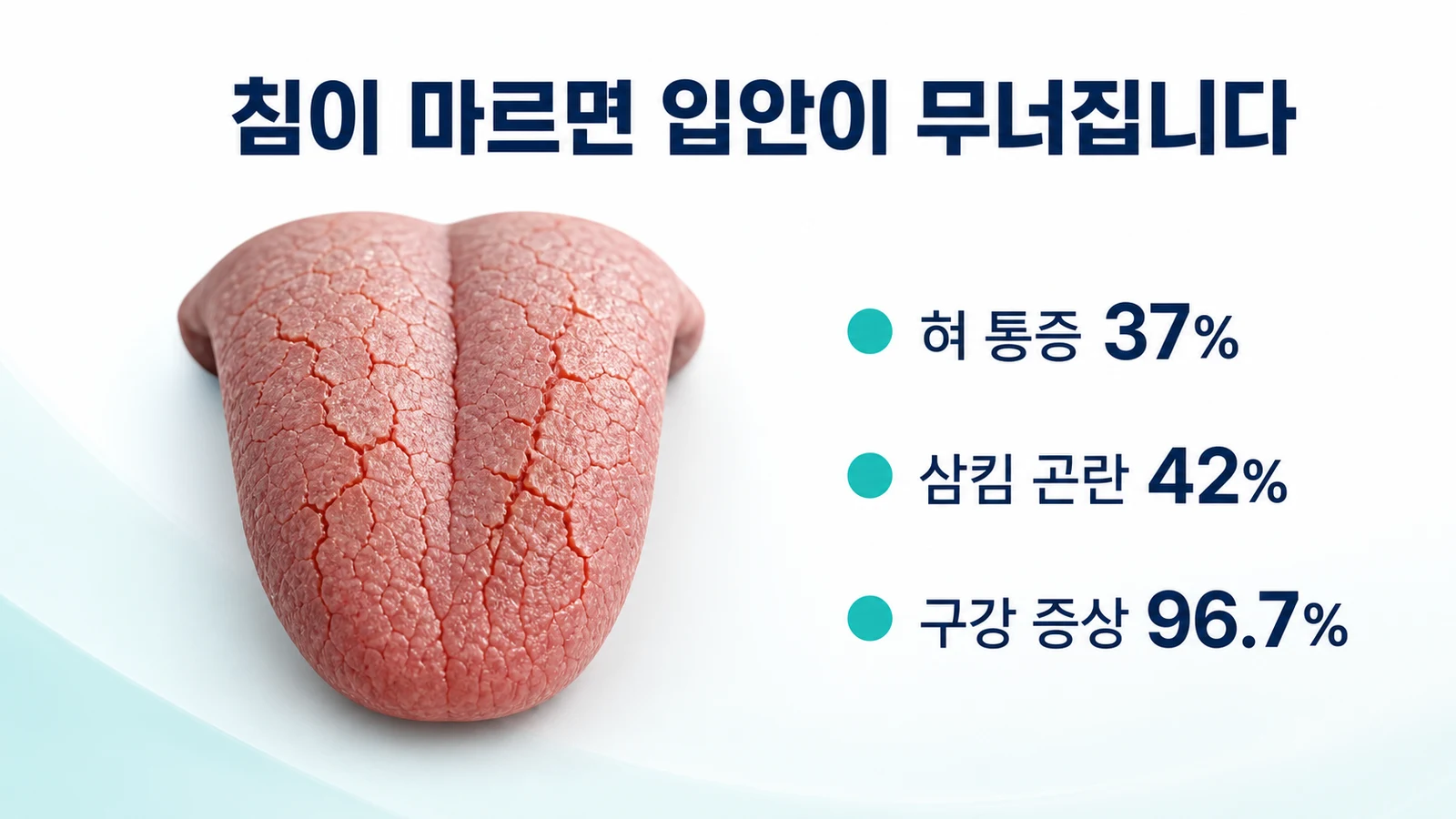 침이 마르면 입안이 무너진다 — 혀 통증·삼킴 곤란