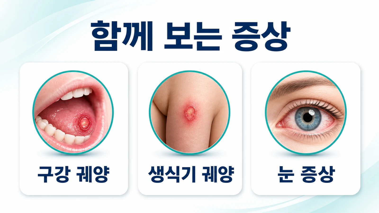 결절홍반·여드름 모양 발진