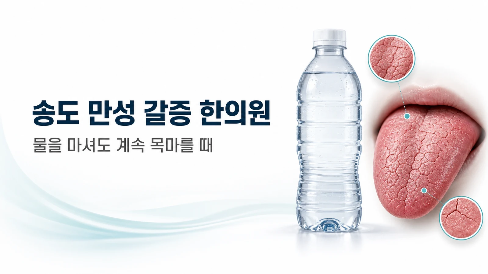 만성 갈증 — 물을 마셔도 계속 목마를 때 치료