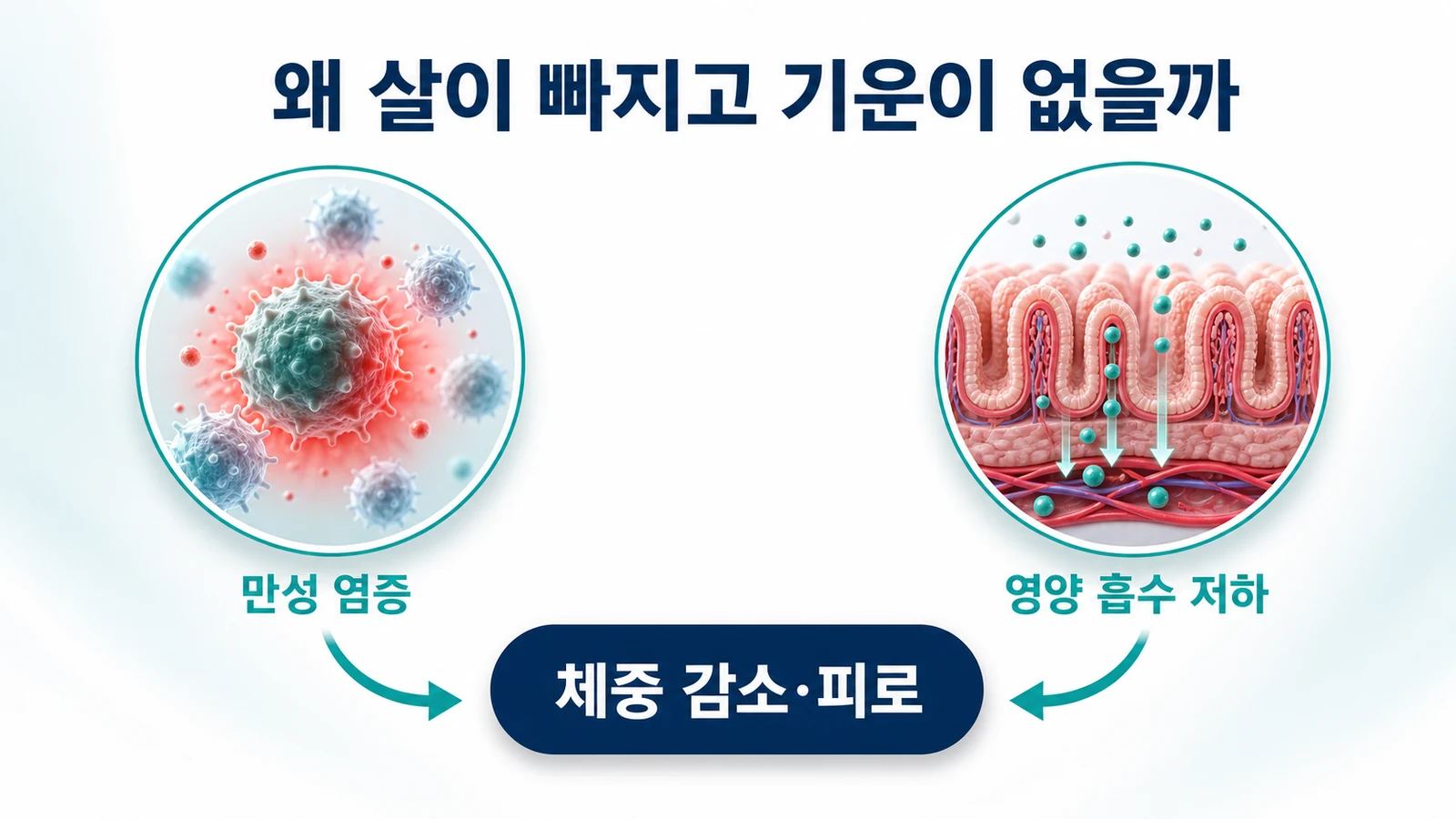 복통·설사·체중 감소가 이어질 때