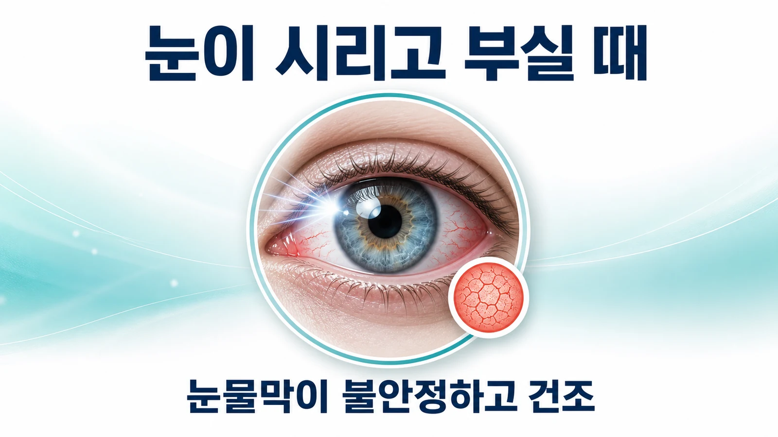 눈이 시리고 부실 때