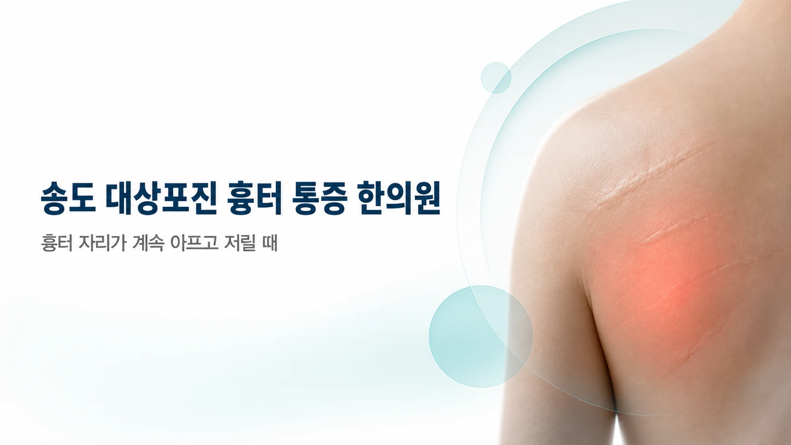 대상포진 흉터 통증 — 흉터 자리가 계속 아프고 저릴 때