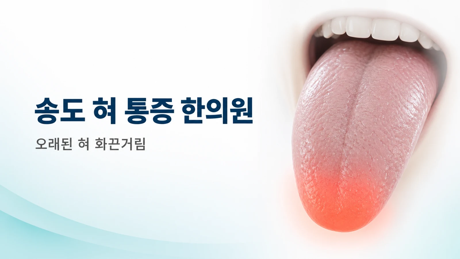혀 화끈거림 — 오래된 혀 통증, 어떻게 치료하나요