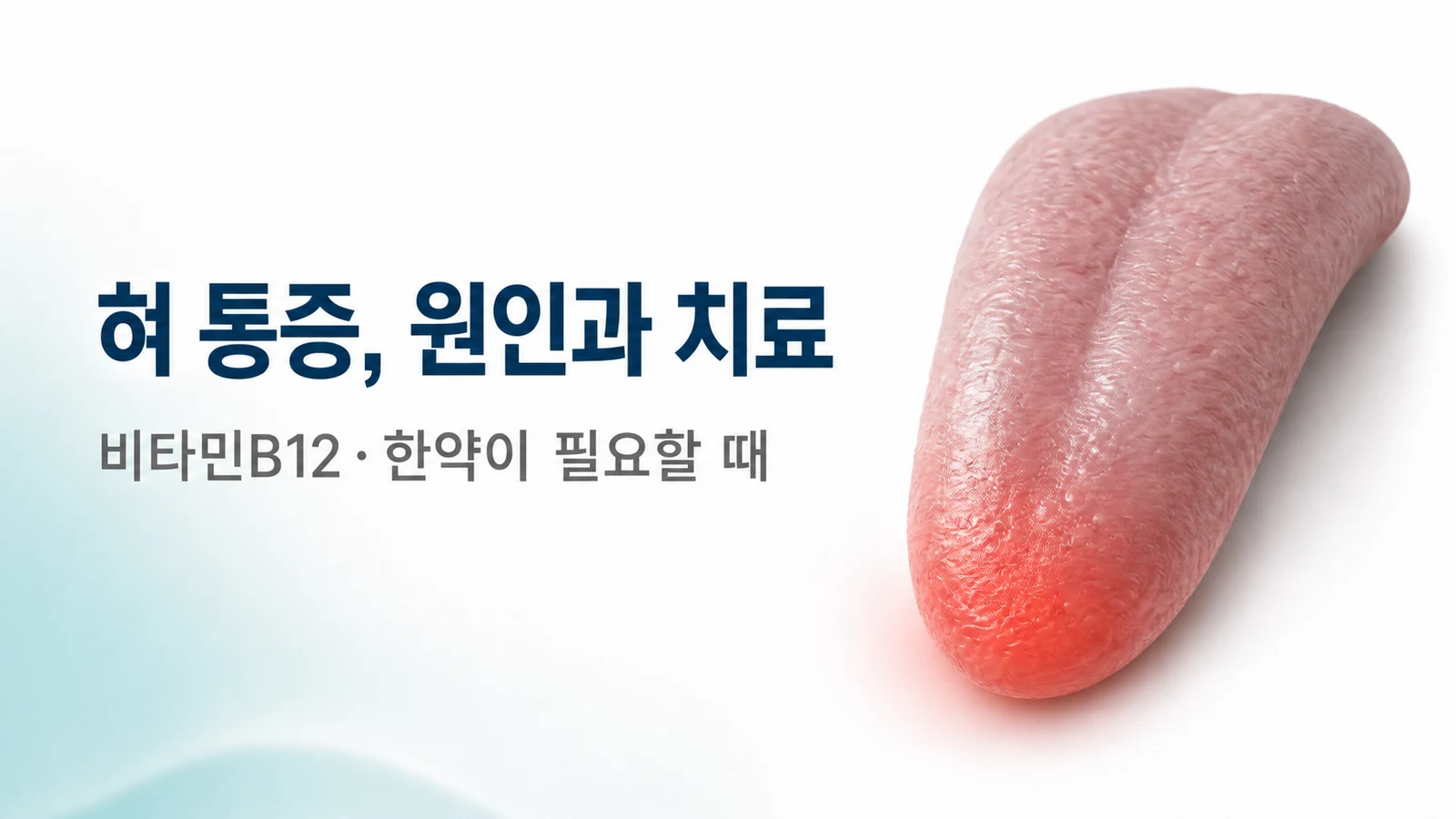 혀 통증, 원인과 치료 — 비타민B12·한약이 필요한 경우
