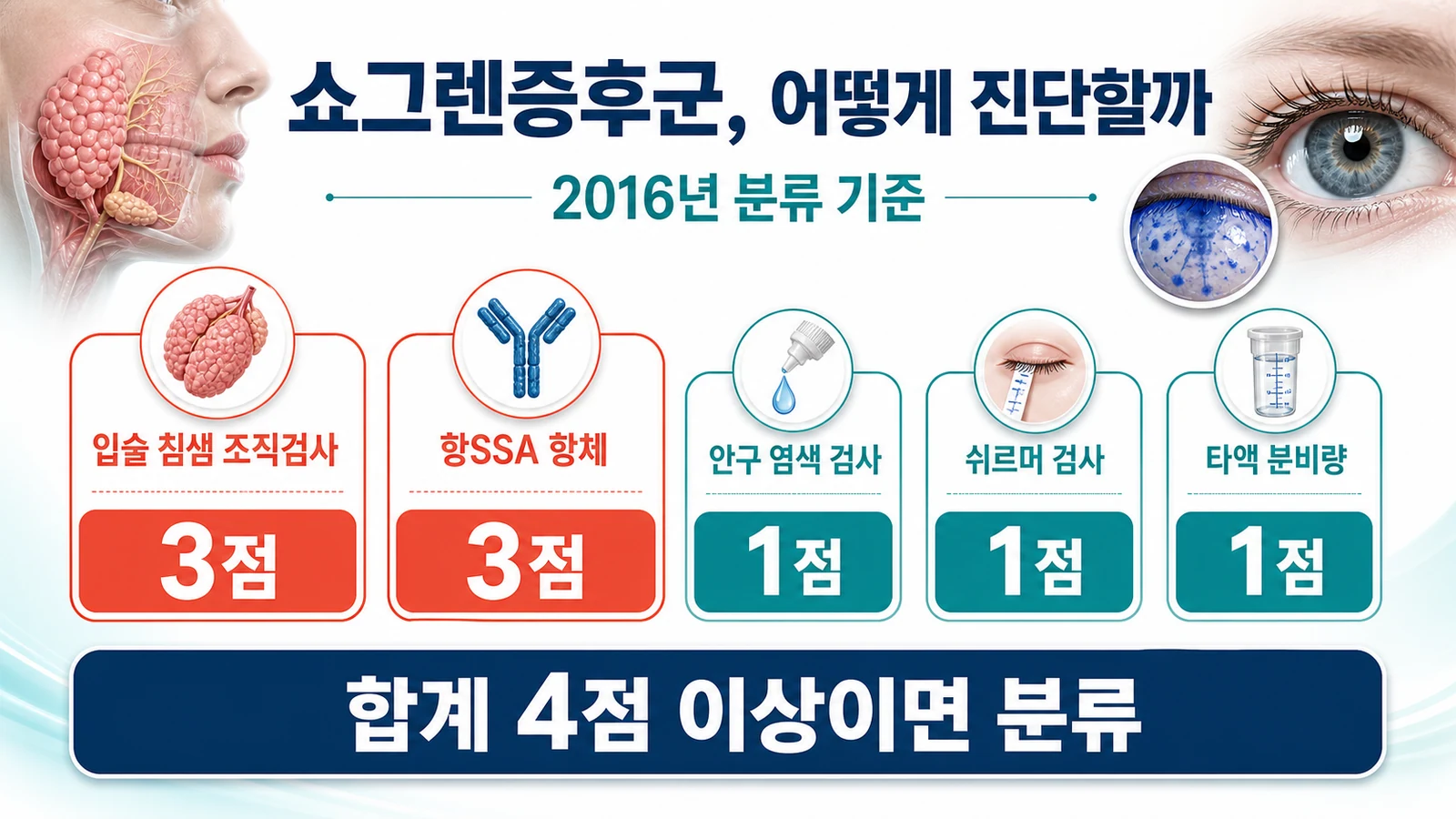 쇼그렌증후군 진단 분류의 최근 지견
